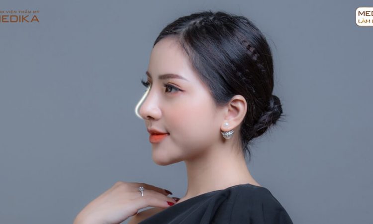Nâng mũi sụn sườn có phải là sự lựa chọn cuối cùng khi thẩm mỹ mũi? -Tại nangmuislinedep.com.vn