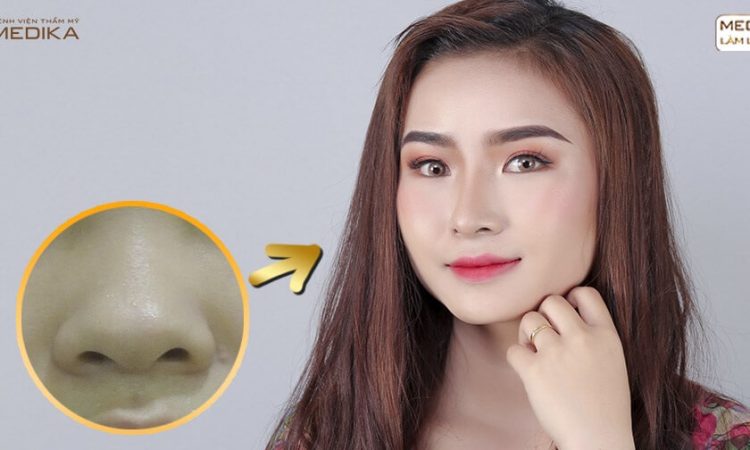 Thu nhỏ đầu mũi có ảnh hưởng đến sức khỏe mũi hay không? - Tại nangmuislinedep.com.vn