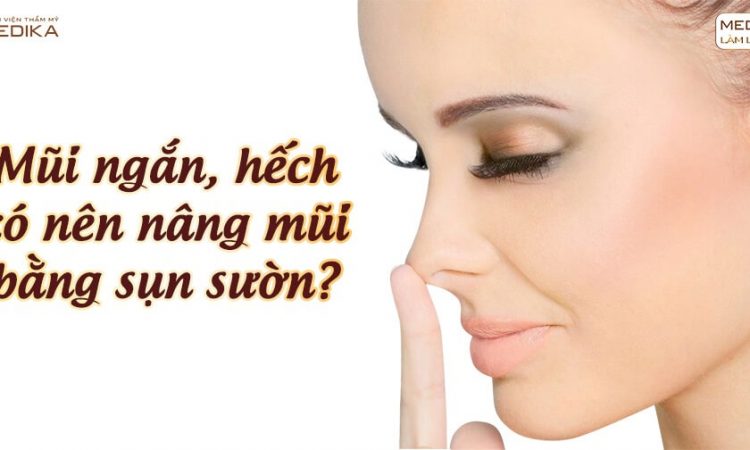 Mũi ngắn và hếch có nên nâng mũi bằng sụn sườn - Nangmuislinedep.com.vn