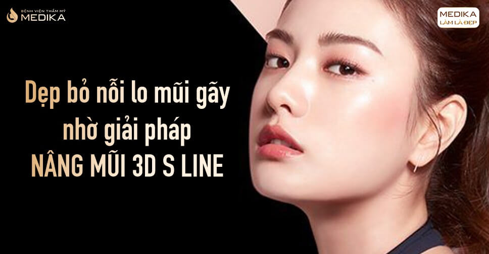 Dẹp bỏ nỗi lo mũi gãy nhờ giải pháp nâng mũi 3D S line - Nangmuislinedep.com.vn