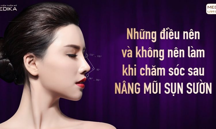 Những điều nên và không nên khi chăm sóc nâng mũi sụn sườn - Nangmuislinedep.com.vn