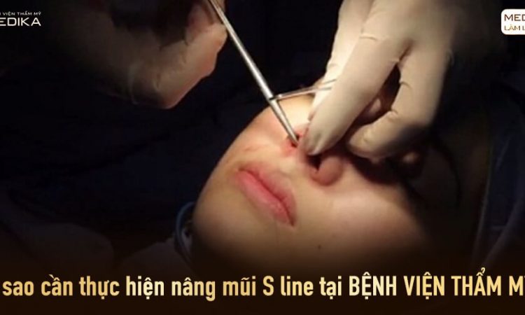 Vì sao cần thực hiện nâng mũi S line tại bệnh viện thẩm mỹ? - Tại Nangmuislinedep.com.vn
