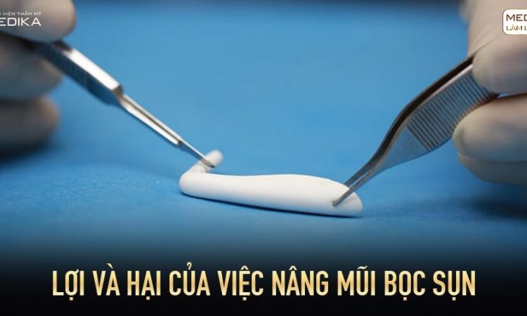 Lợi và hại của việc nâng mũi bọc sụn từ Nangmuislinedep.com.vn